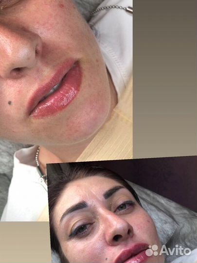 Услуги косметолога