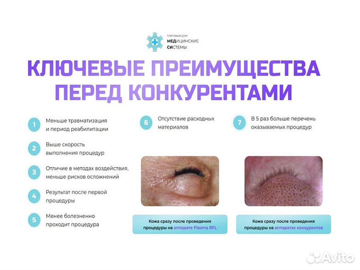 Косметологический аппарат Plasma A