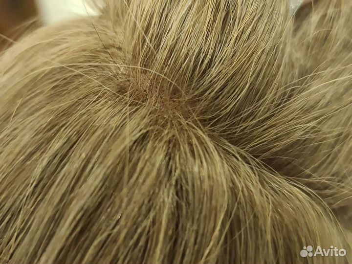 Система замещения волос, накладка hair talk