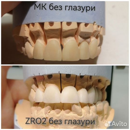 Зуботехнические работы