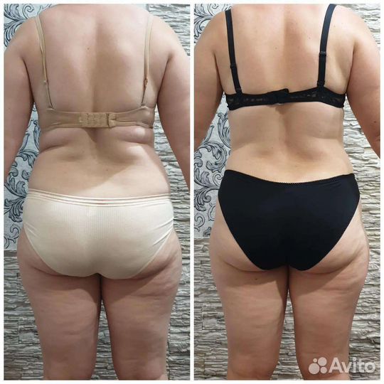 Коррекция фигуры/ скульптурный массаж