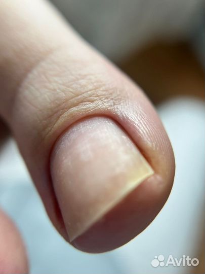 Педикюр с покрытием лаком