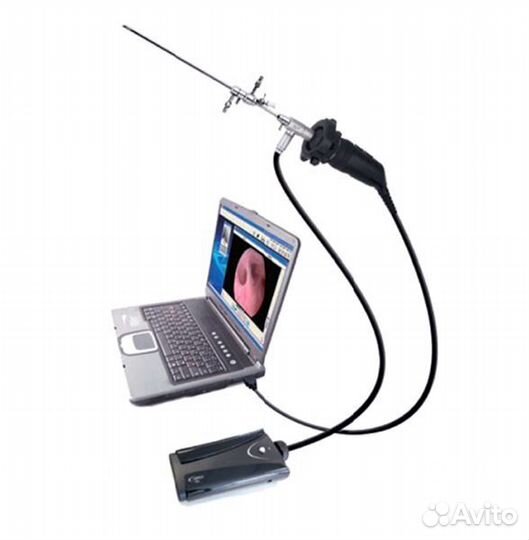 Гистероскоп