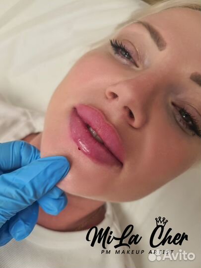 Увеличение губ