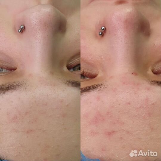 Косметолог-эстетист