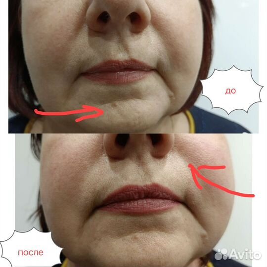 Массаж лица