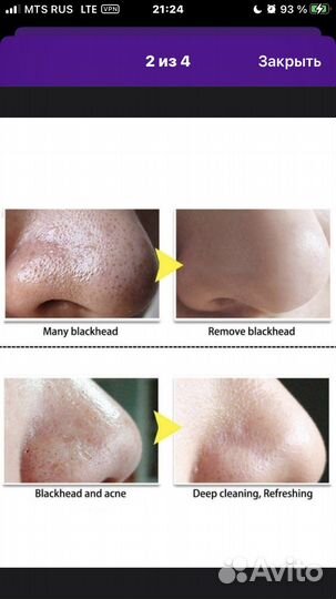 Маска для лица Lanbena очищающая от акне