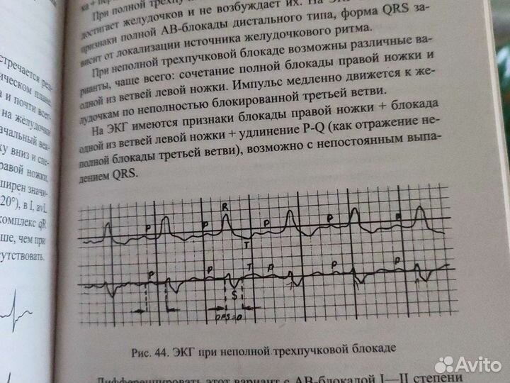 Медицинская литература Терапия