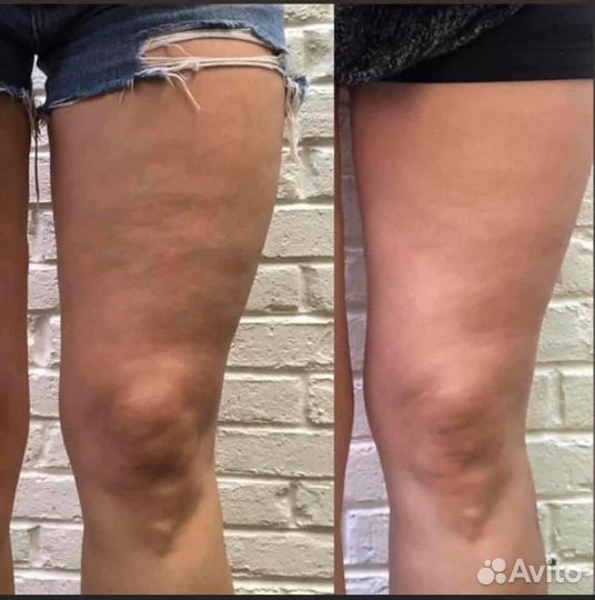 Экспресс похудение когда нет времени