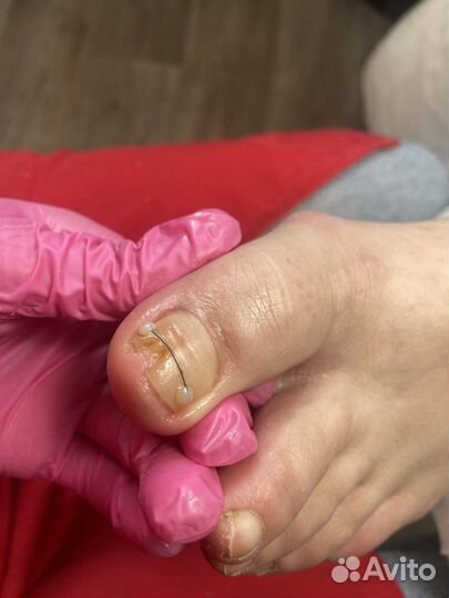 Услуги подолога