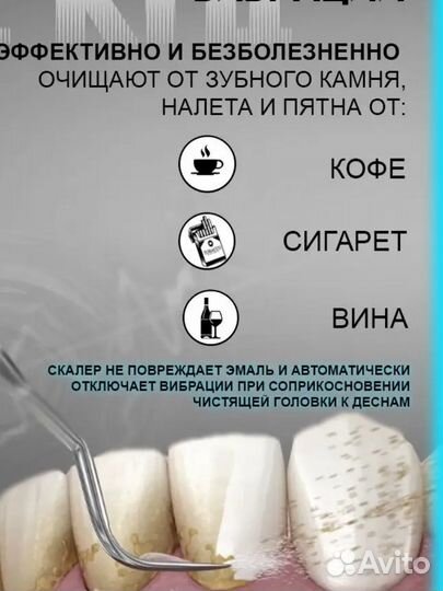 Ультразвуковой скалер