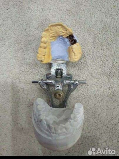 Слепок зубов челюсти из гипса