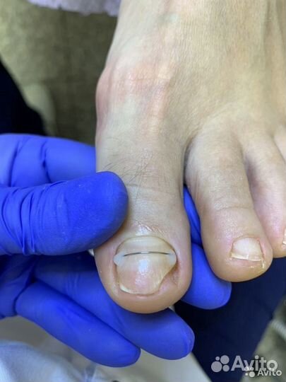 Подолог, педикюр
