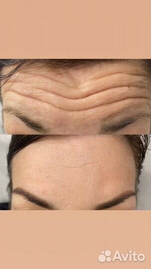 Услуги косметолога