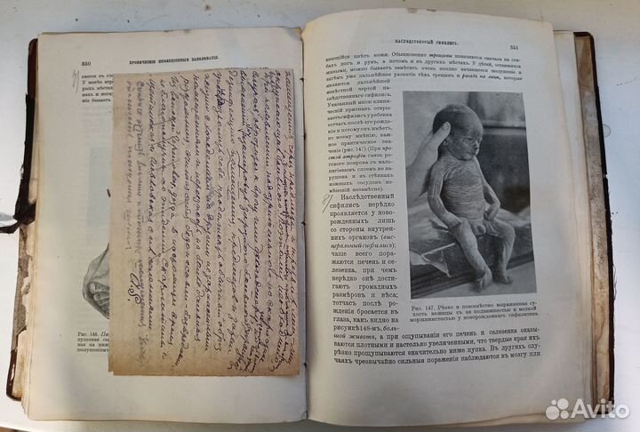 Курс детских болезней