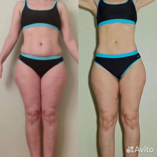 Массаж/ коррекция фигуры