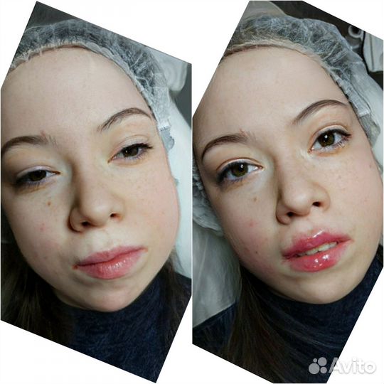 Все виды косметологии