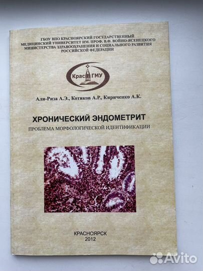 Хронический эндометрит