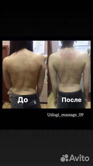 Услуги массажа