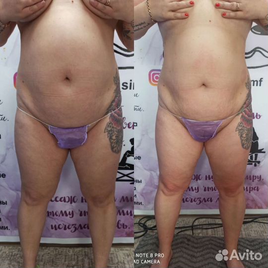 Массаж коррекция фигуры