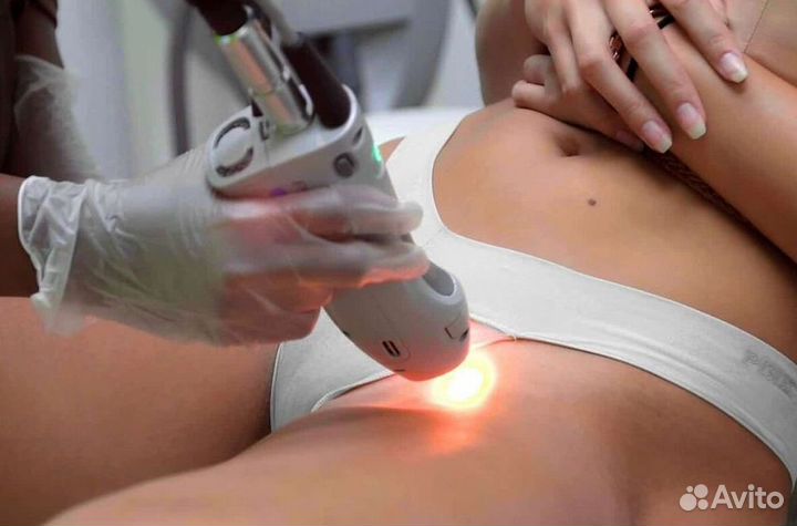 Готовый бизнес: центр лазерной эпиляции