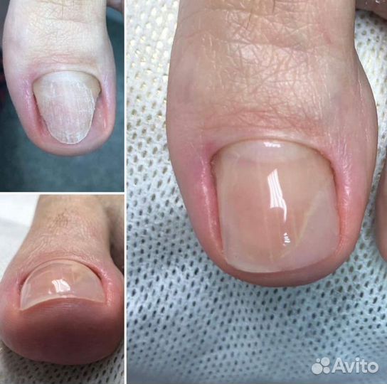 Подолог с медицинским образованием