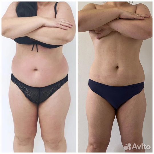 LPG вортекс бифлекси