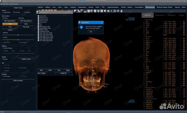Invivo 7.1.3 2024 года