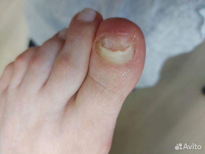 Маникюр/педикюр/медицинский педикюр