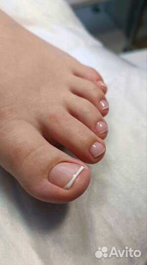 Педикюр покрытие пяточки ЖК Восток