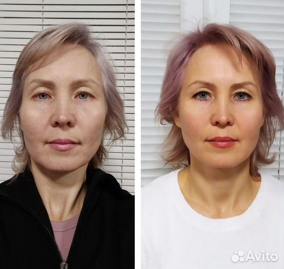 Омолаживающий массаж лица. Коррекция осанки,массаж