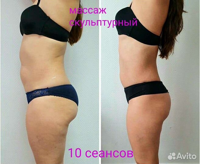 Массаж лица и тела. Коррекция фигуры