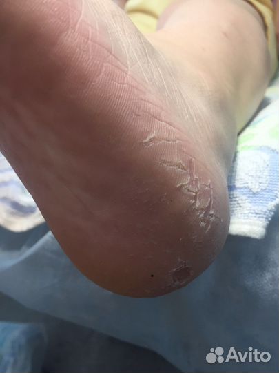 Классический педикюр