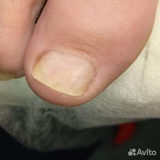 Педикюр,Подолог