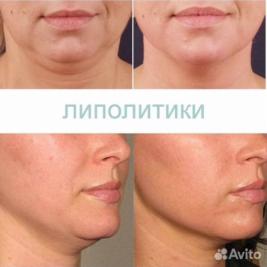 Липолитики