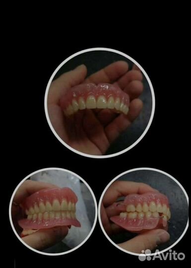 Изготовление и починка зубных протезов