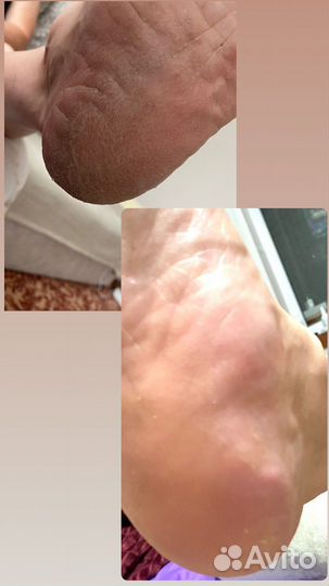 Педикюр (Fani Ben Ami)