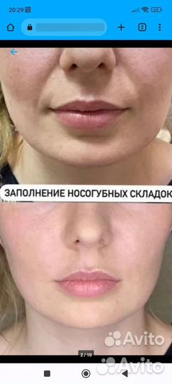 Все для молодости, красоты,стройности