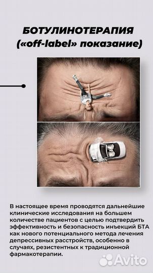 Ботокс для лица