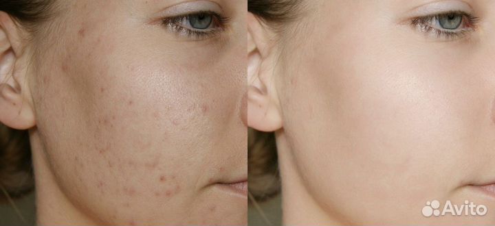 Мобильная обработка фото