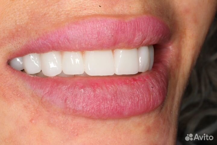 Врач стоматолог ортопед имплантолог