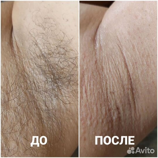 Спа-депиляция (сахар,воск), Кривко, Сосново