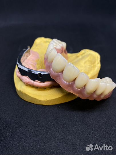 All on 4 протез, изготовление