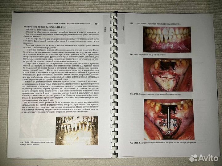 Дентальная имплантация учебная литература