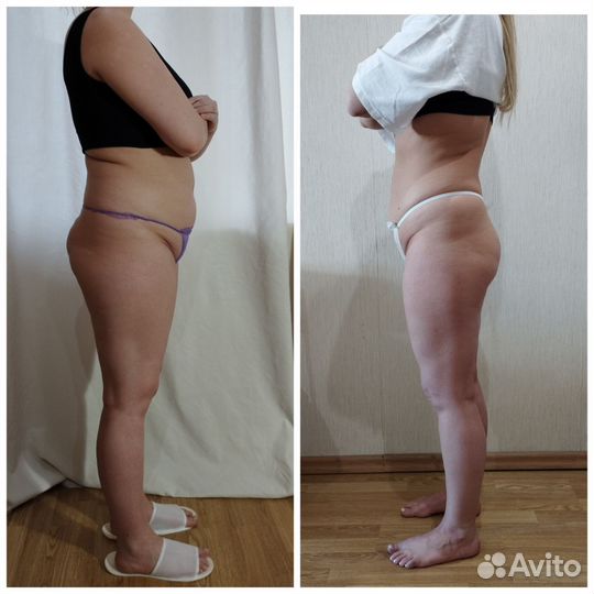 Массаж, антицеллюлитный массаж