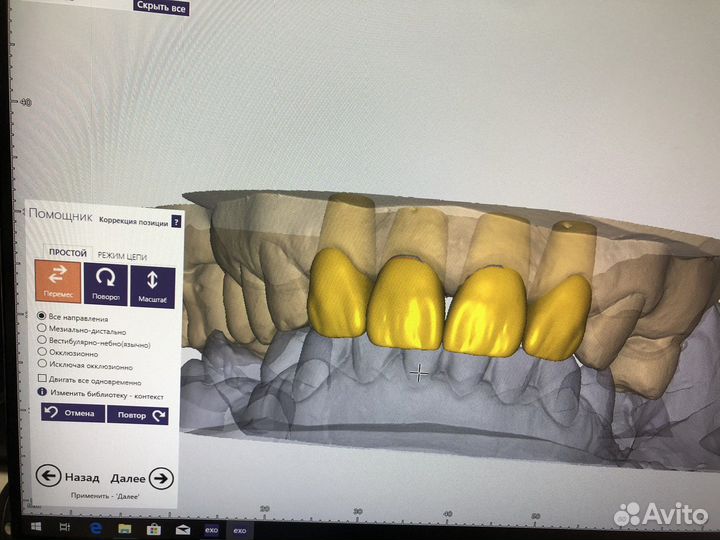 3D моделирование в программах exocad, 3Shape