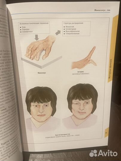 Атлас-справочник по неврологии