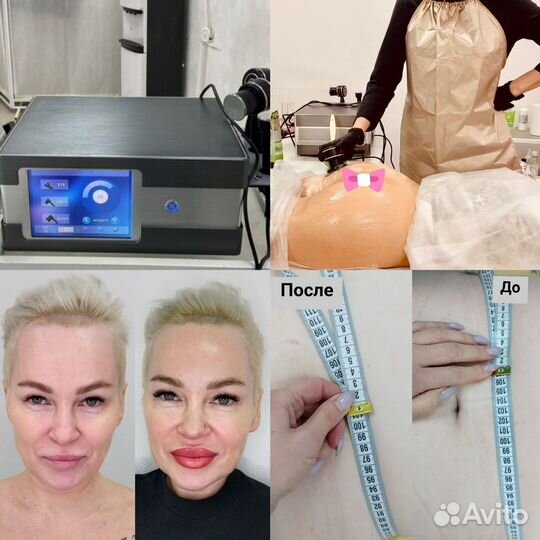 Обучение ret cet индиба indiba