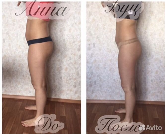 Массаж на результат, не поглаживаю. Депиляция