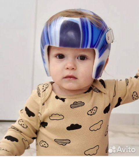 Ортопедический шлем